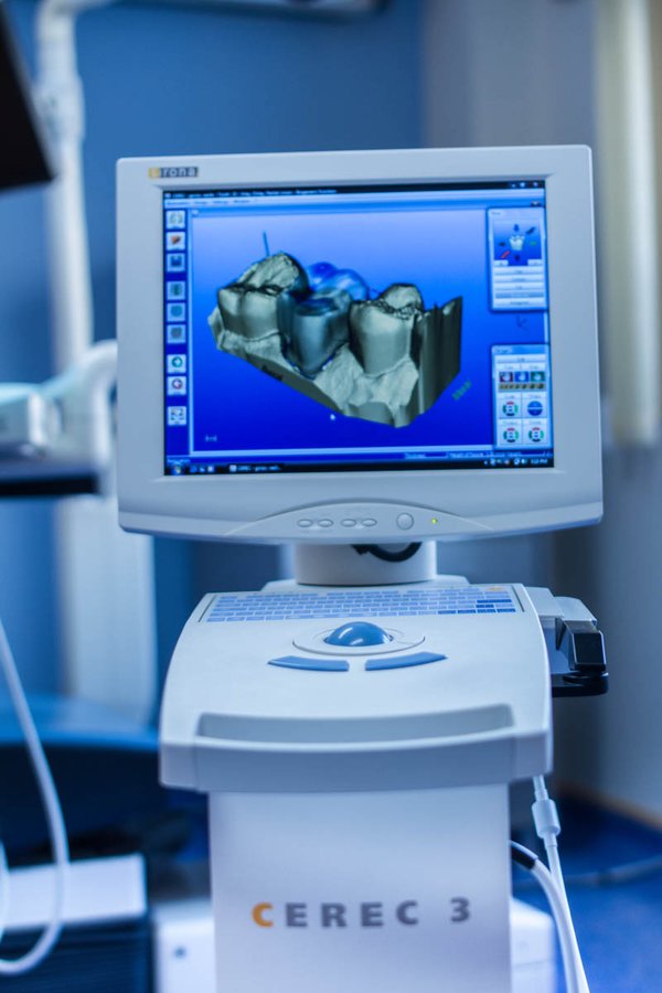 Smart Dental - Smart Dental